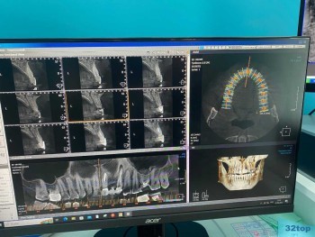 Стоматологическая клиника ОЛДЕНТ м. Преображенская площадь