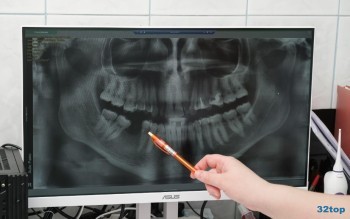 Стоматологическая клиника АССОЛЬ м. Буревестник