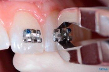 Стоматологическая клиника ВЕГА м. Верхние Лихоборы