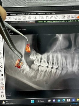 Стоматология ELNOR MEDICAL (ЭЛЬНОР МЕДИКАЛ) м. Бунинская аллея