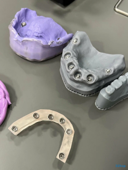 Клиника ПОЛНЫЙ ПОРЯДОК НА ТУРКУ м. Международная