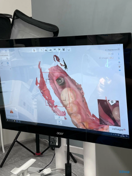 Клиника ПОЛНЫЙ ПОРЯДОК НА ТУРКУ м. Международная