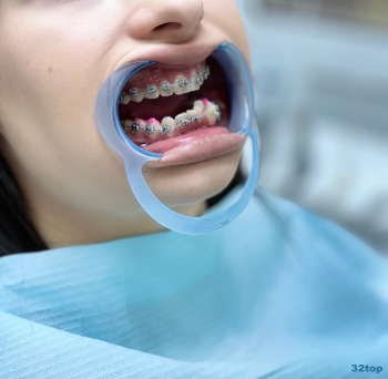 Стоматологическая клиника DIAMANT ЭКСПЕРТ (ДИАМАНТ ЭКСПЕРТ) на Спортивной