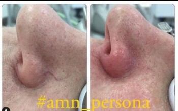 Клиника эстетической и антивозрастной медицины AMN PERSONA (АМН ПЕРСОНА)