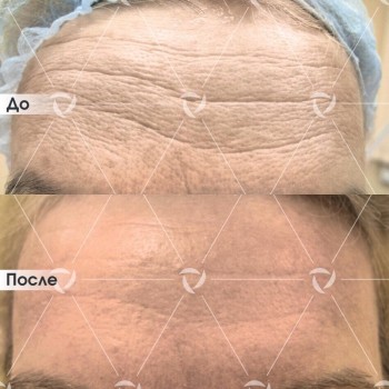 Клиника лазерной косметологии ЛИНЛАЙН