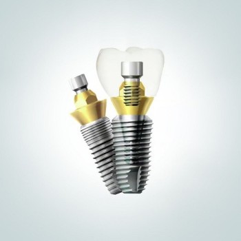 Имплант SuperLine или INNO всего за 35000 руб.