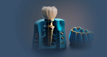 Зуб под ключ за 39000 рублей