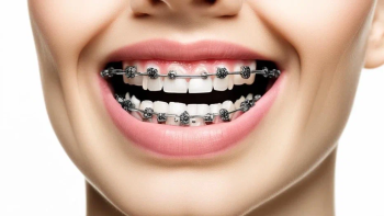 Брекет-система (пр-во США) от 19000 рублей