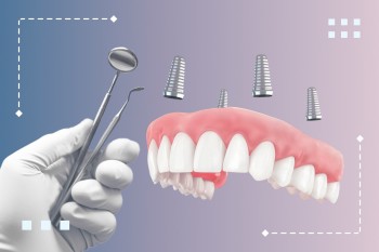 При тотальных имплантациях - скидка на терапию 15%