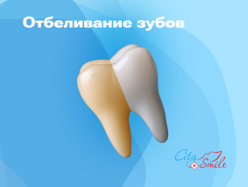 Отбеливание зубов за 12900 р.