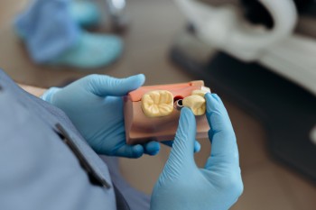 Бесплатная консультация стоматолога-ортопеда!