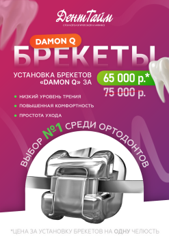 Брекеты Damon за 65000 руб.