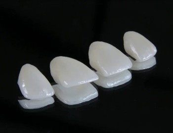Керамические виниры E-max - 18000 руб.