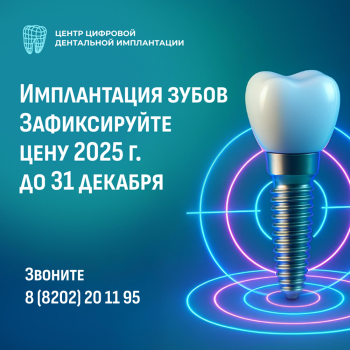 Фиксируем цены 2025 года на имплантацию зубов