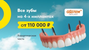 Все зубы на 4-х имплантах от 110000 ₽