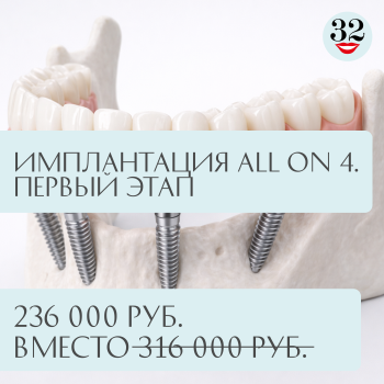 Акция! Имплантация All-on-4! 