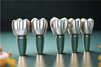 Имплантация All-on-4 и All-on-6 — 149000 р.