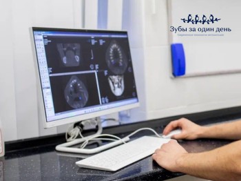 Бесплатная консультация с хирургом-имплантологом