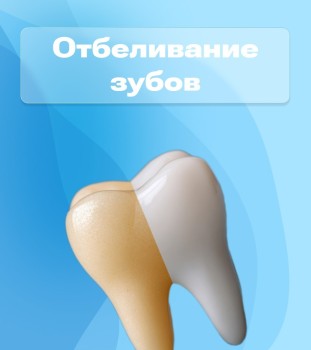Отбеливание зубов за 14900 р.