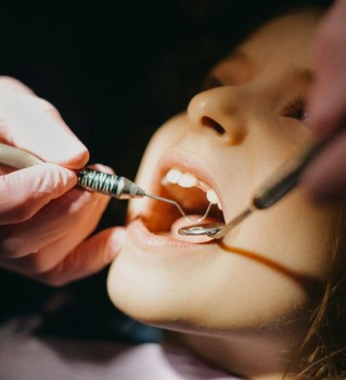 Лечение кариеса 3-ех молочных зубов по цене 2-ух