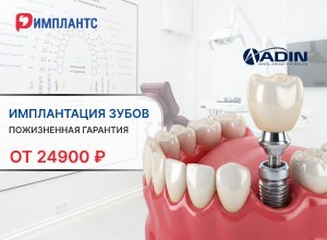 Имплантация зуба под ключ за 24900 ₽