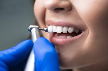 Гигиена полости рта за 3500 руб.