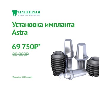Установка импланта Astra за 69750 р.