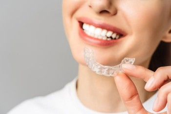 Акция на элайнеры StarSmile (Стар Смайл) 10%