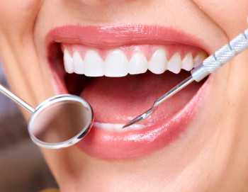 Профессиональная гигиена зубов ко Дню Рождения!