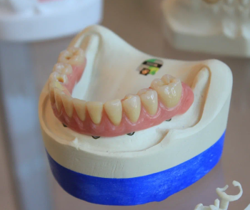 Протезирование «Все на 4» всего за 290000 руб.